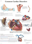 Common Cardiac Disorders - Anatomical Chart